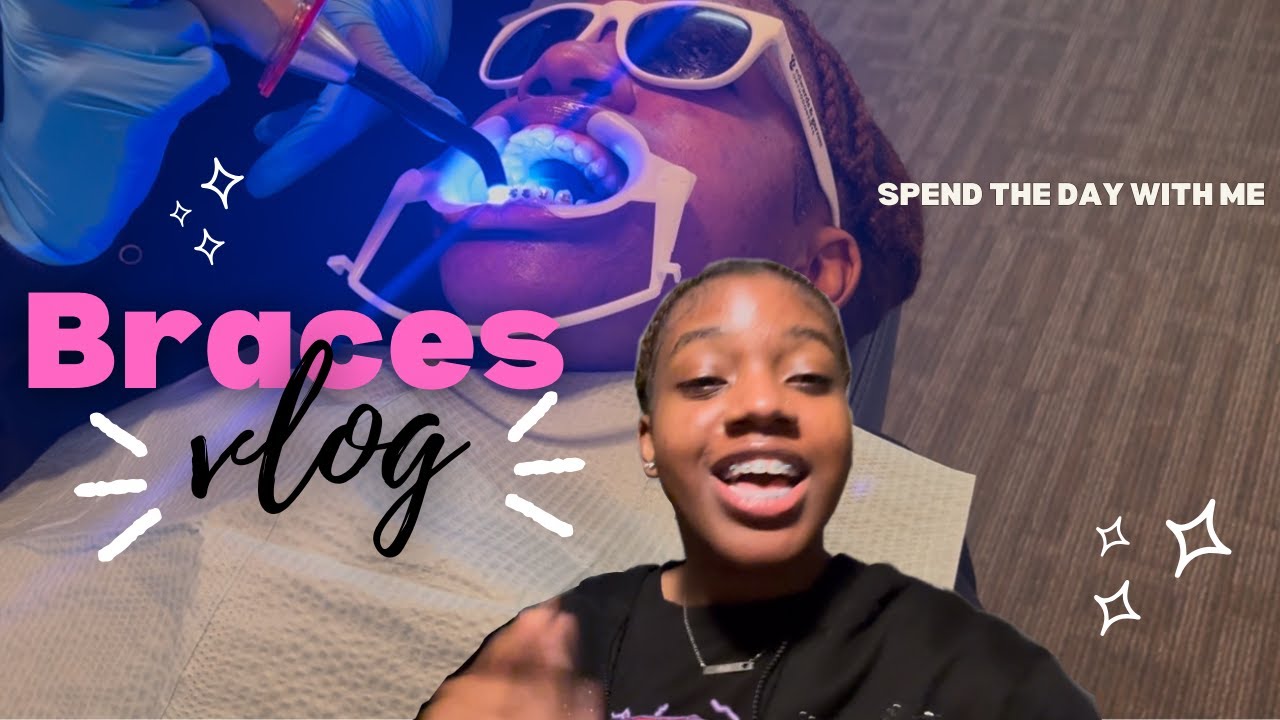 Come Get Braces with Me!!