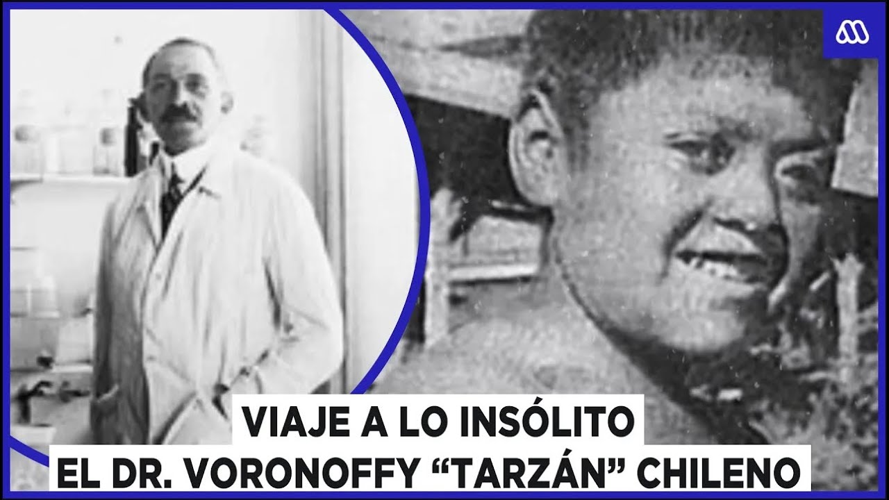Viaje a lo insólito | La historia del Dr. Voronoff y el niño 