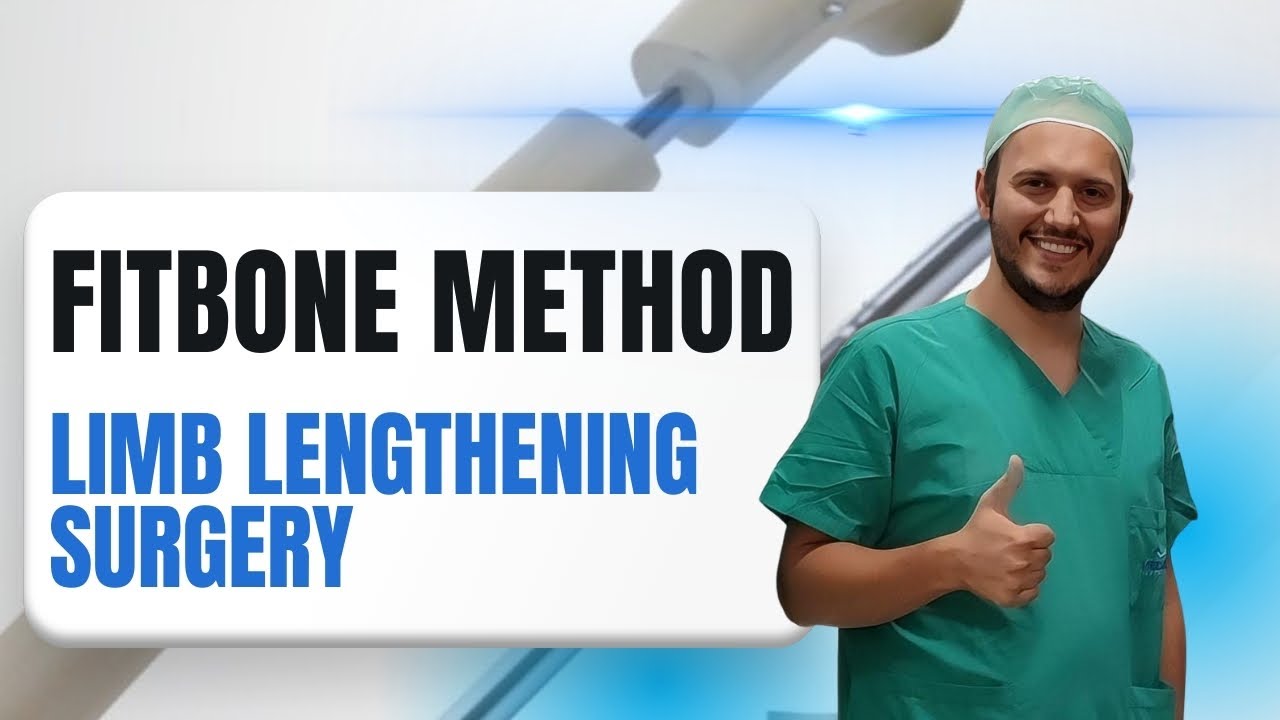 Fitbone Limb Lengthening Surgery Explained | How It Works, Safety & Realistic Results