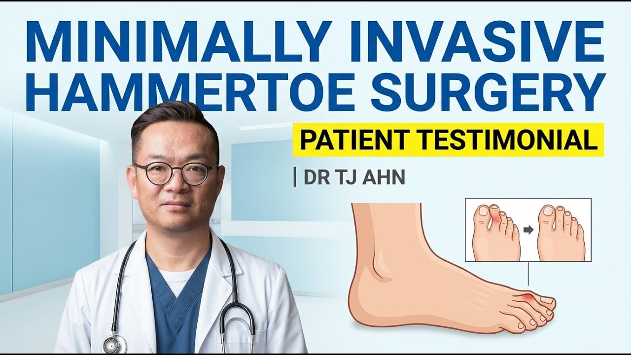 Minimally Invasive Hammertoe Surgery Patient Testimonial  │ Dr  TJ Ahn