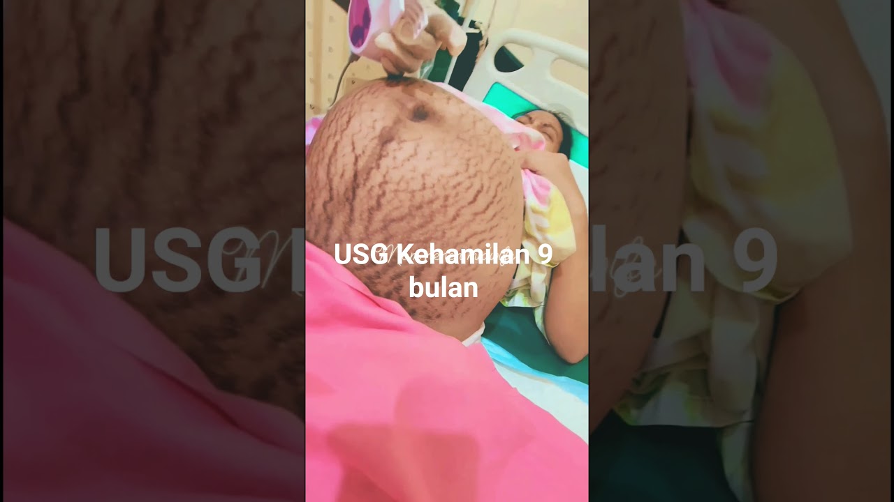 USG Kehamilan 9 bulan #pregnant #bumil