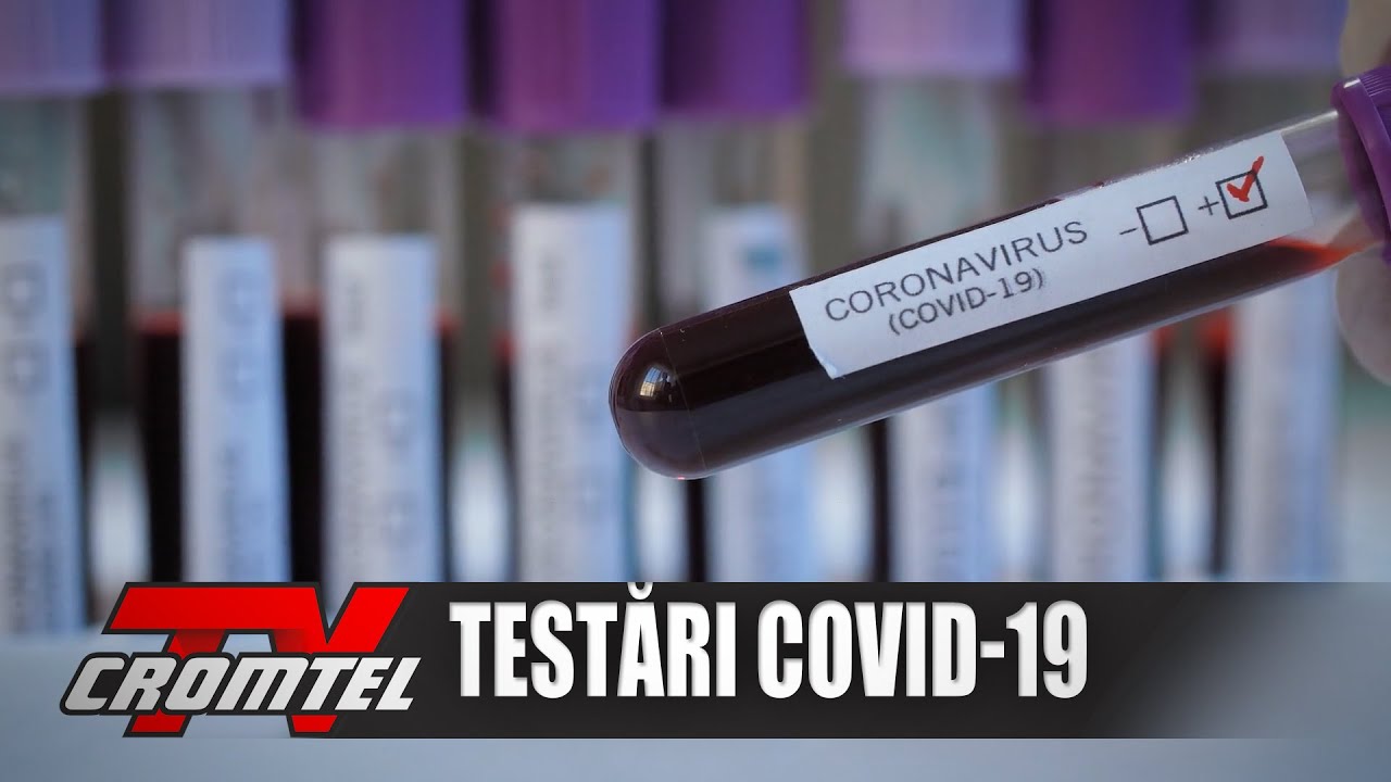 ȘTIRI CROMTEL TV -  Patru laboratoare din județul Suceava fac teste COVID-19 pentru călătorii