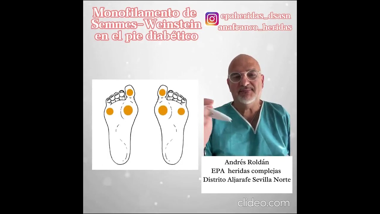 Uso de monofilamento de Semmes-Weinstein en pie diabético con Ana Franco y Andrés Roldán
