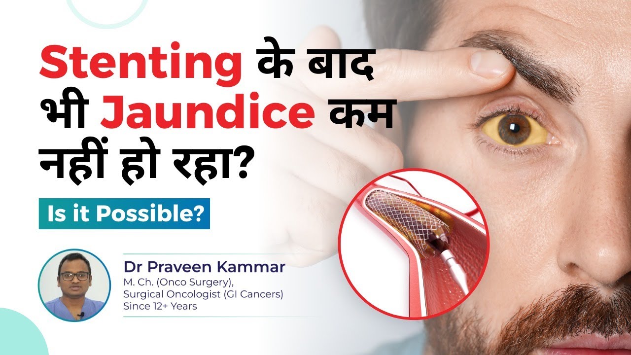 Stenting के बाद भी Jaundice कम नहीं हो रहा? Is it Possible? | Jaundice and Stenting | Dr Praveen