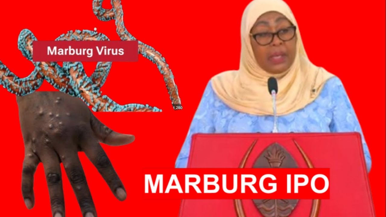 MMOJA AKUTWA NA UGONJWA WA  MARBURG KAGERA  :RAIS SAMIA ATOA TAARIFA RASMI