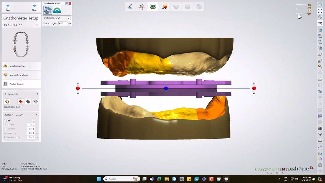3D Biteplate Design