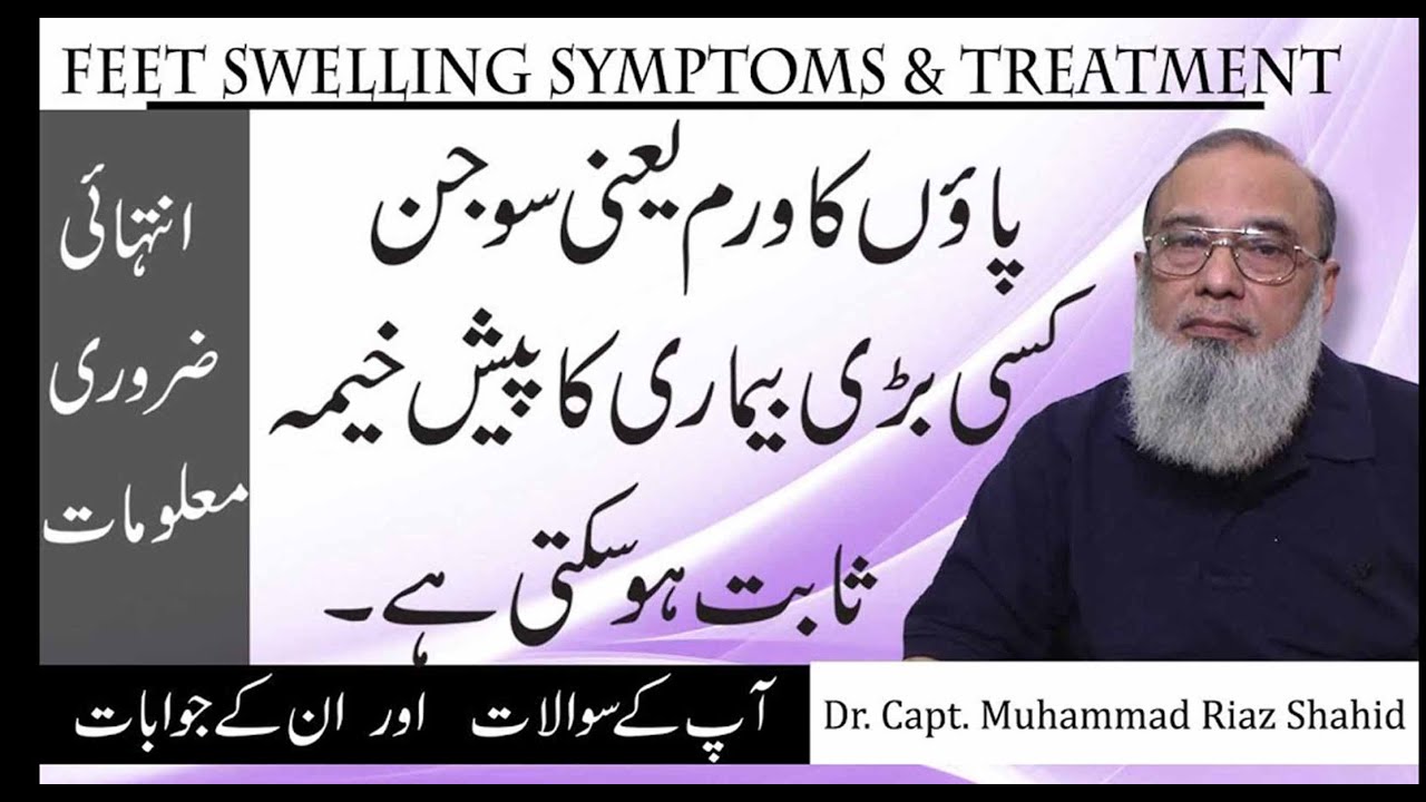 Feet Swelling Causes And Treatment In Urdu Hindi || Paon ki sujan ka ilaj || Paon ki sujan