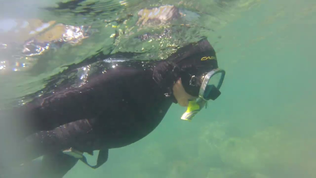 apnea chome1