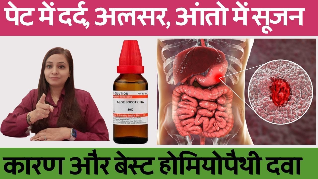 पेट में दर्द बने रहना, पेट में अलसर, आंतो में सूजन का इलाज | pet me ulcer homeopathic medicine