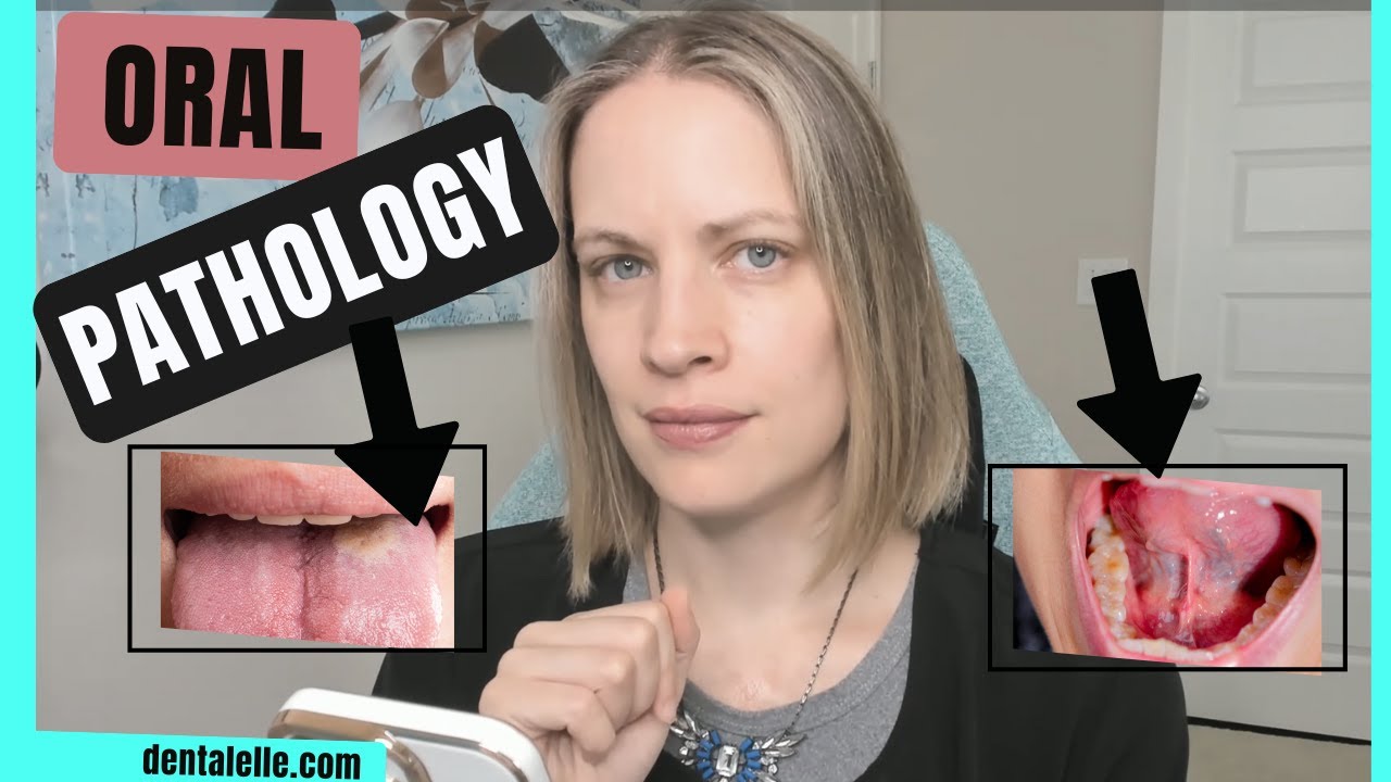 Case Study Questions and Rationales on Oral Pathology