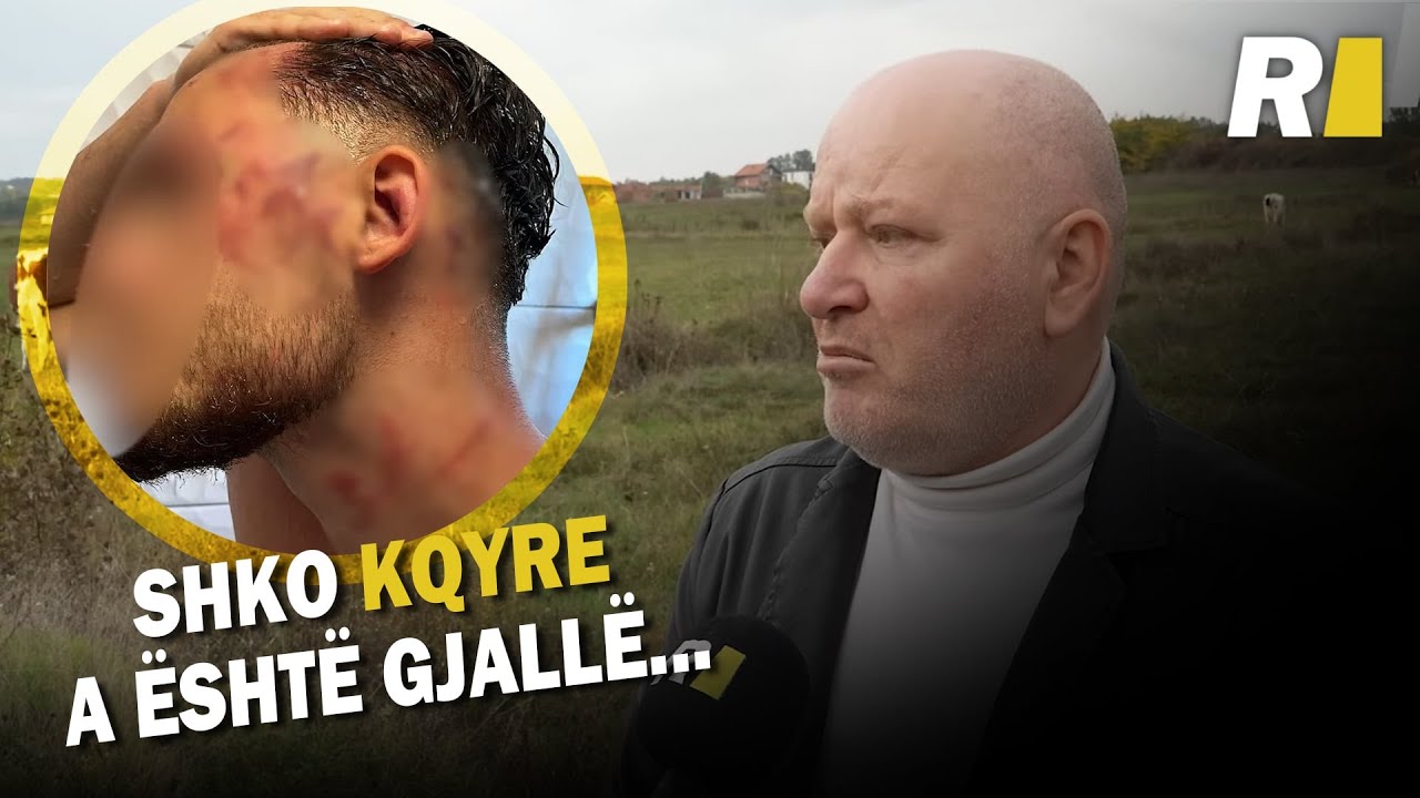 &ldquo;Shko kqyre a &euml;sht&euml; gjall&euml;...&rdquo; &ndash; P&euml;rplasja p&euml;r mexh&euml; eskalon n&euml; dajak mes kush&euml;rinjve n&euml; Gjakov&euml;