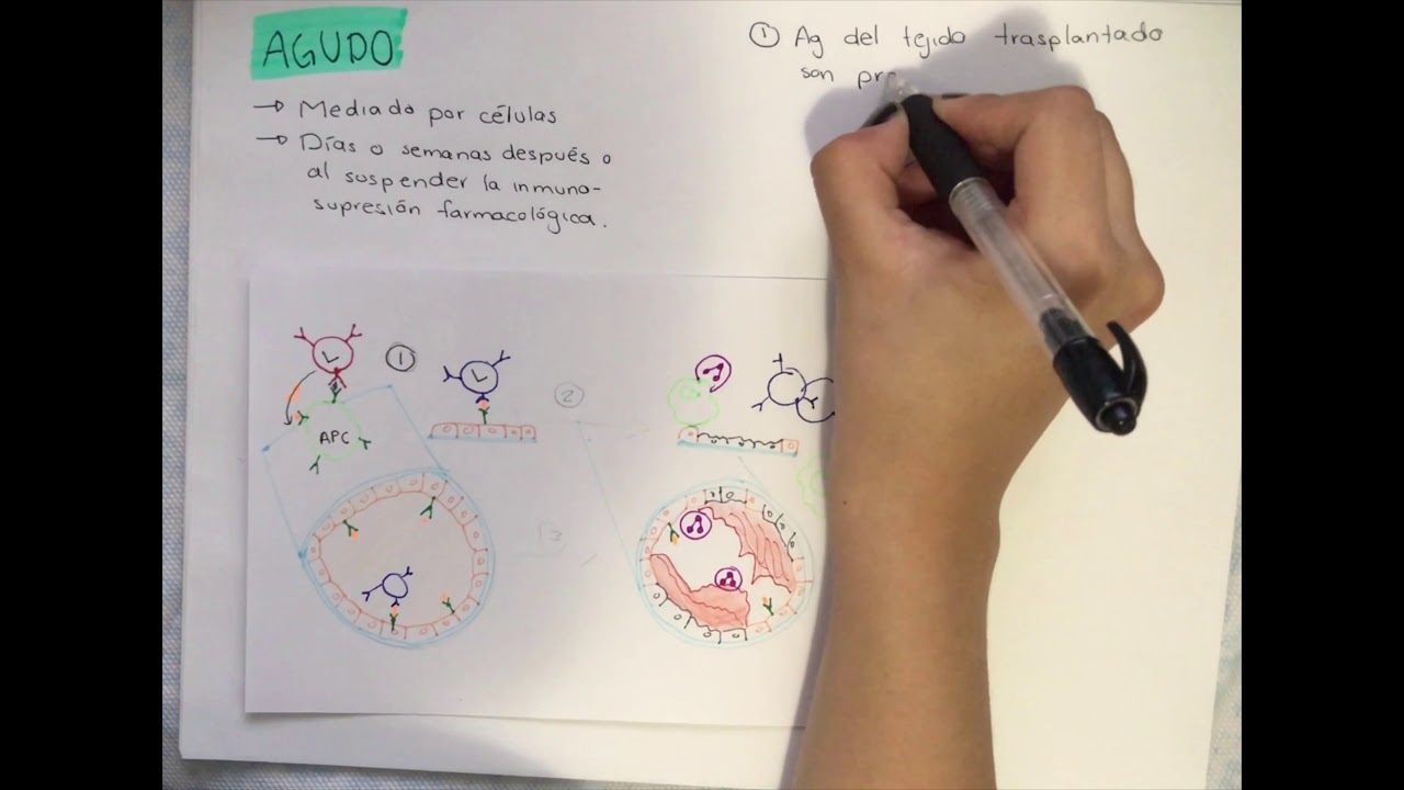 Respuesta inmune y trasplantes