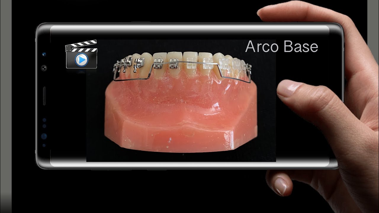 Arco Base - confecção e ativações.