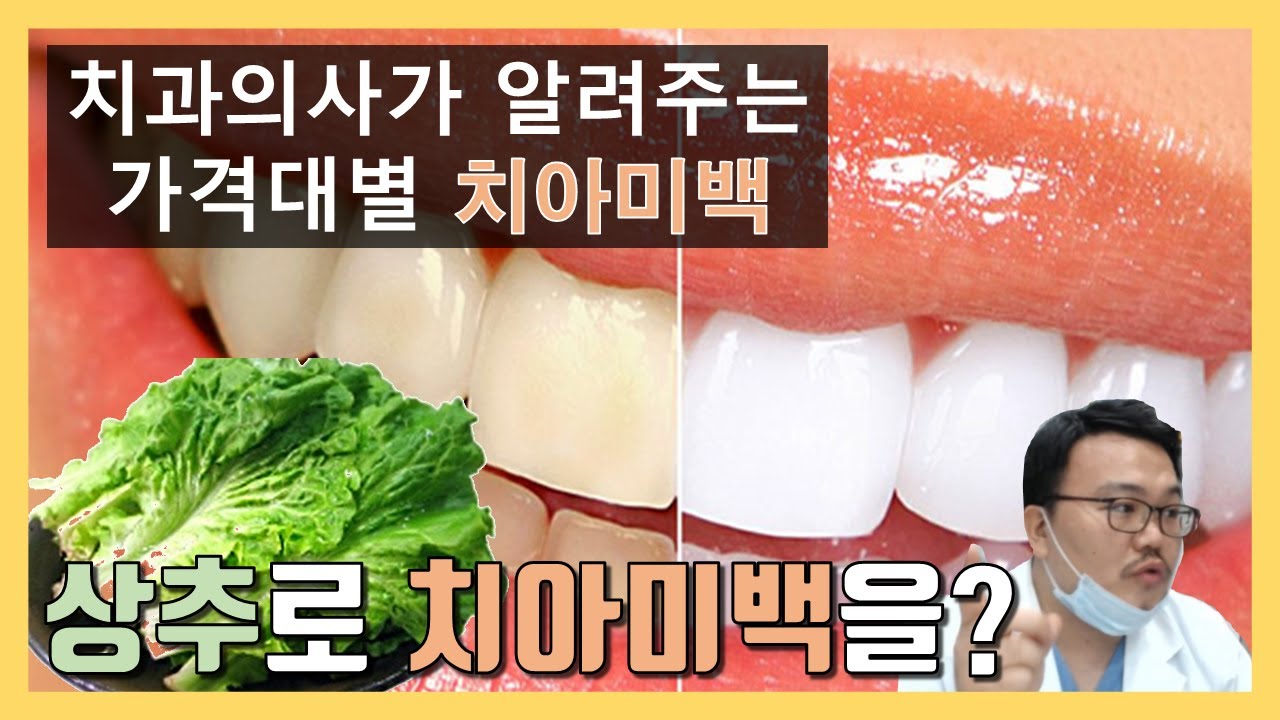 치과의사가 알려주는 가격대별 치아미백 방법.