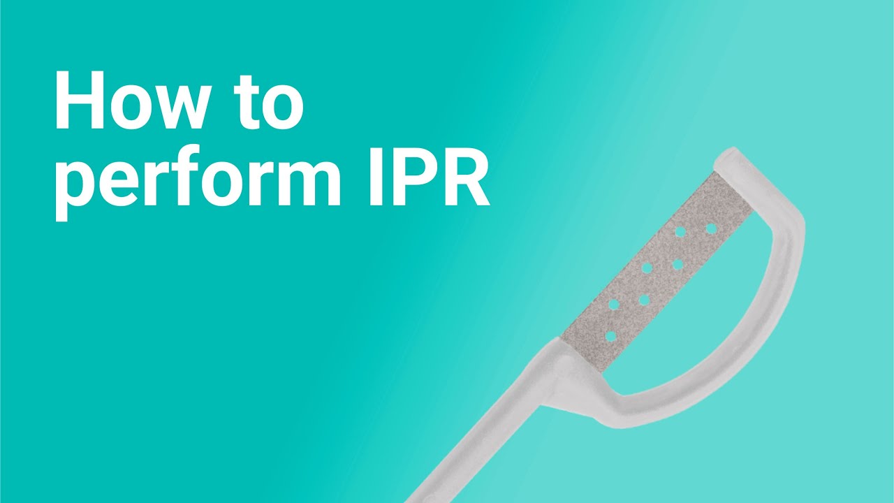 Как выполнить IPR (интерпроцедуру межреберного смыкания) для прозрачных элайнеров: пошаговая инст...