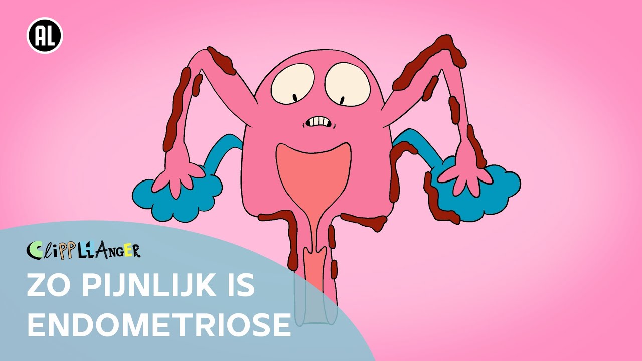 Wat is endometriose?