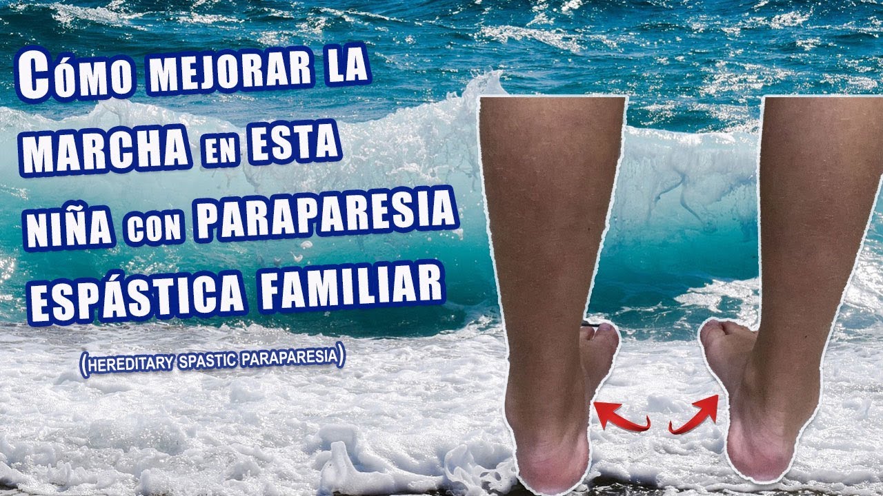 PARAPARESIA ESPASTICA FAMILIAR: cómo mejoramos su forma de caminar
