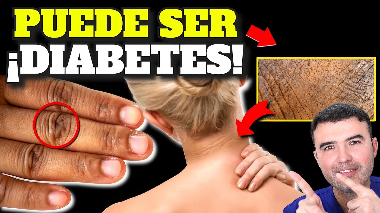 DIABETES En Etapa Inicial: 4 Se&ntilde;ales Que Todos Deben Conocer, DIABETES En Desarrollo