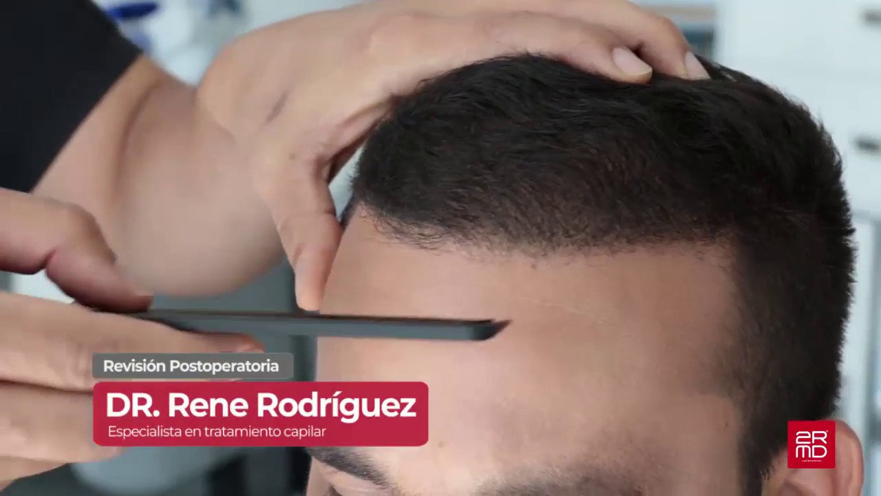 Gervis  Video del Resultado