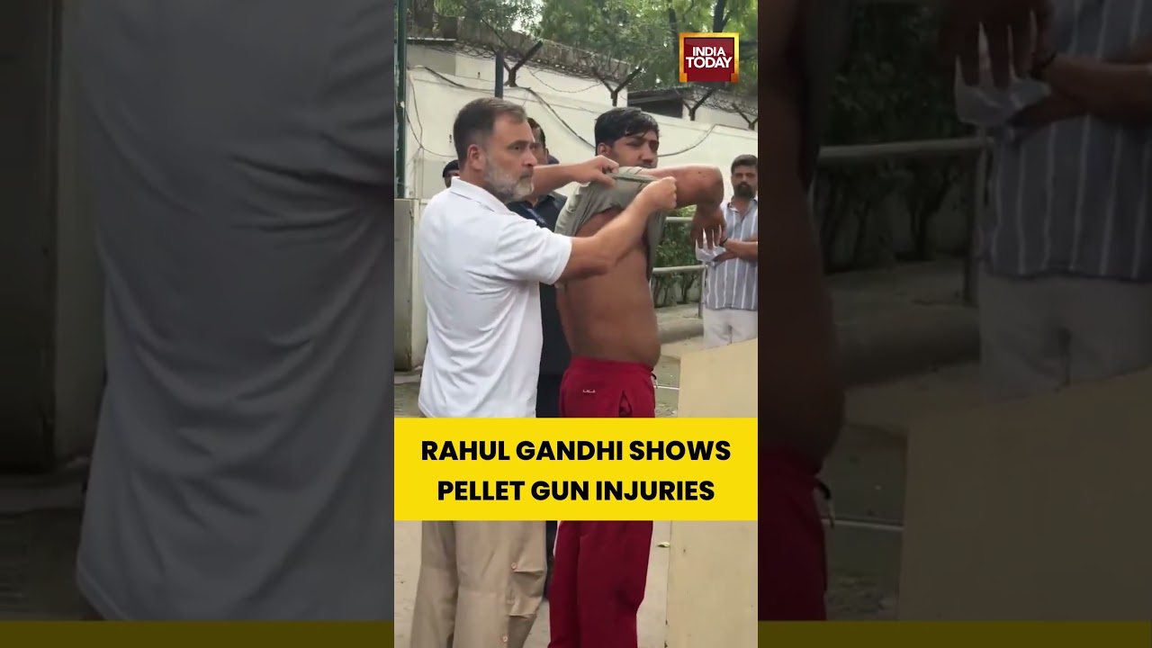 RAHUL GANDHI SHOWS PELLET GUN INJURIES #rahulgandhi #cjpprotest #pelletguns #shortsviral