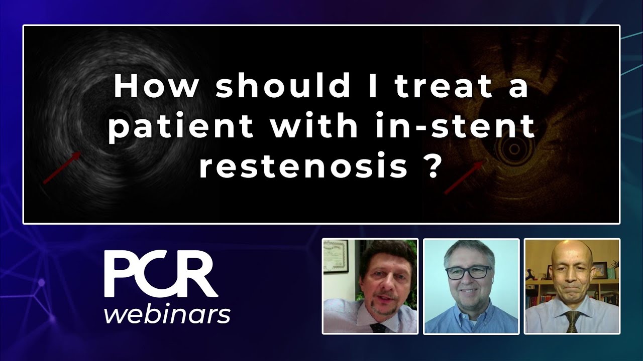 How should I treat a patient with in-stent restenosis ? - Webinar
