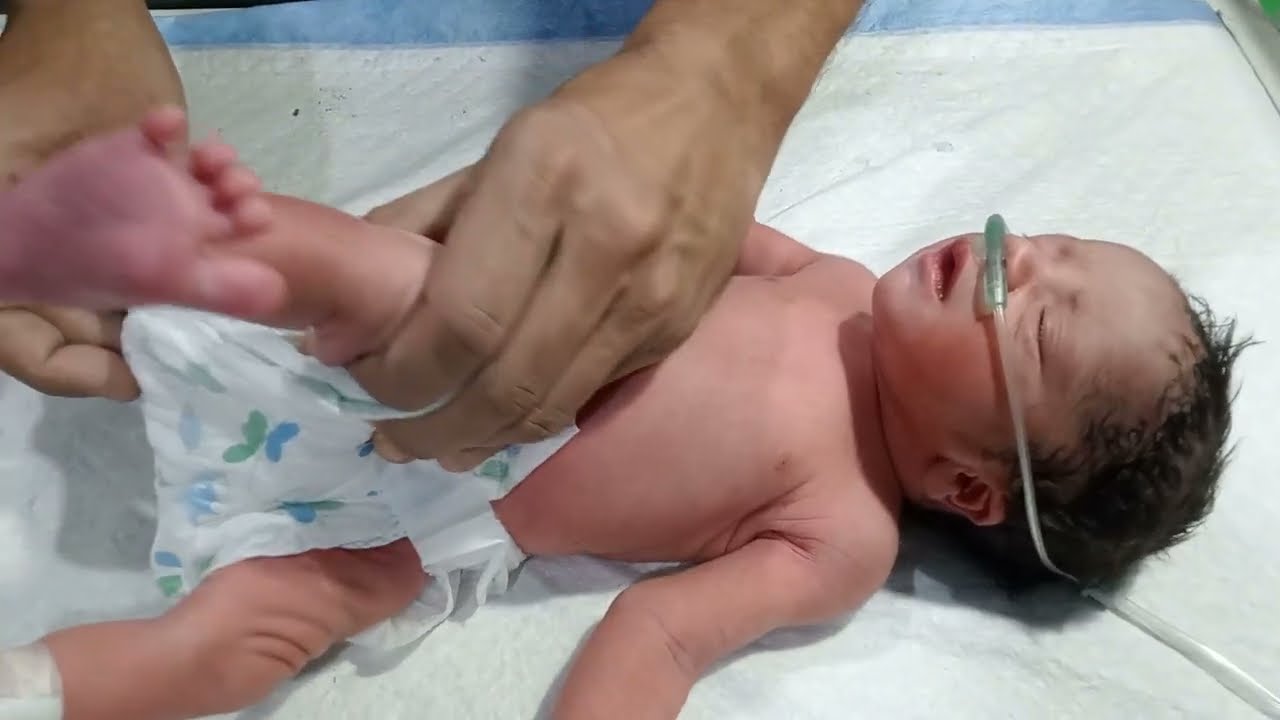 How to Assess a Premature Low Birth Weight Baby | Newborn Diagnosis Explained