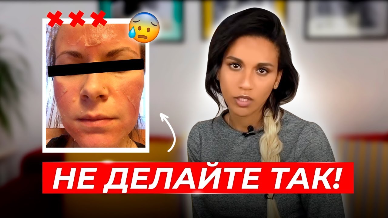 Салициловый пилинг у косметолога// Почему салициловая кислота- это не ВНА// Что не так с салицилкой?