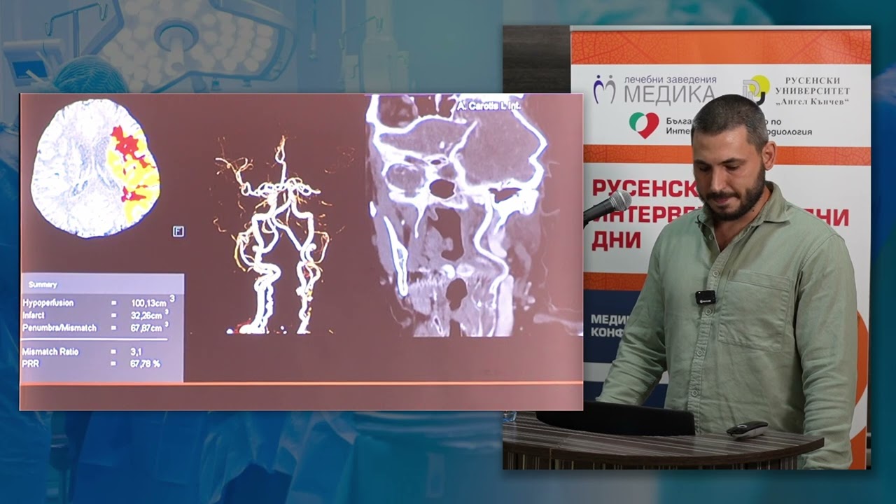 16. AI при диагностика на остър ИМИ
