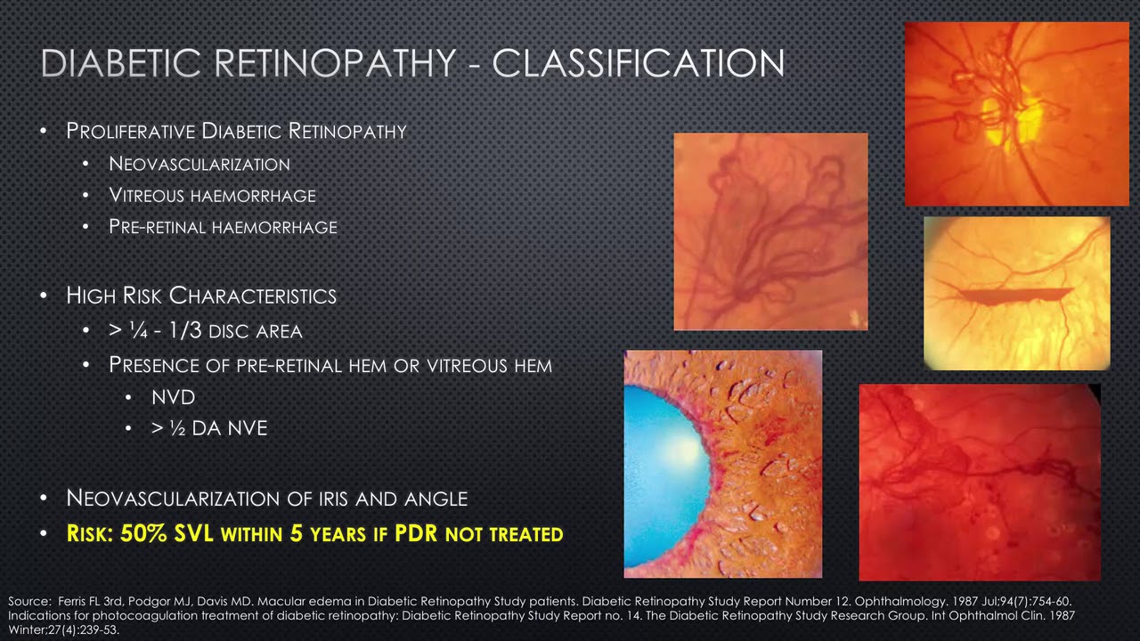 Diabetic Retina Disease - Update 2017: Dr. Wai-Ching Lam & Dr. Peng Yan
