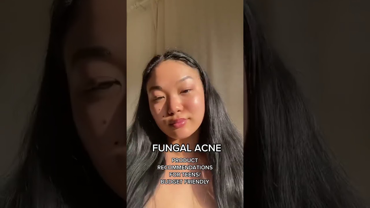 Fungal Acne Safe Skincare #fungalacne #malasseziafolliculitis