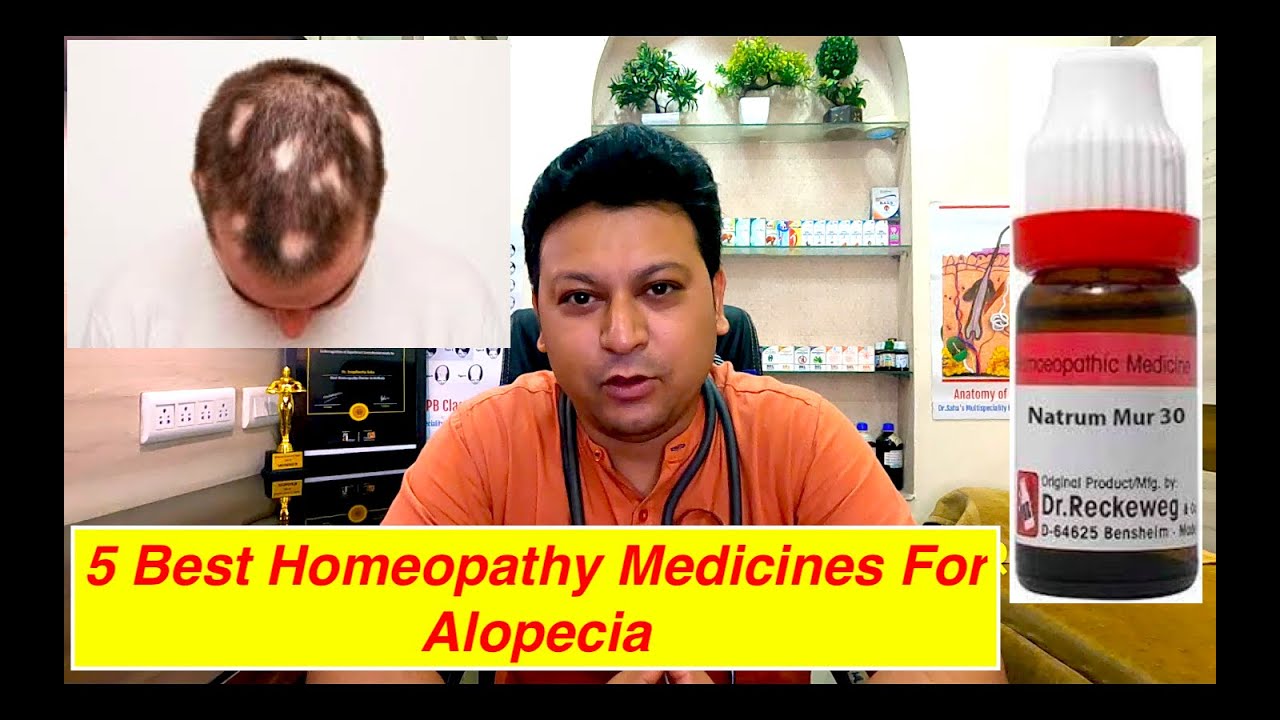 5 best homeopathy medicines for alopecia with 2 bonus medicines | best alopecia areata treatment
