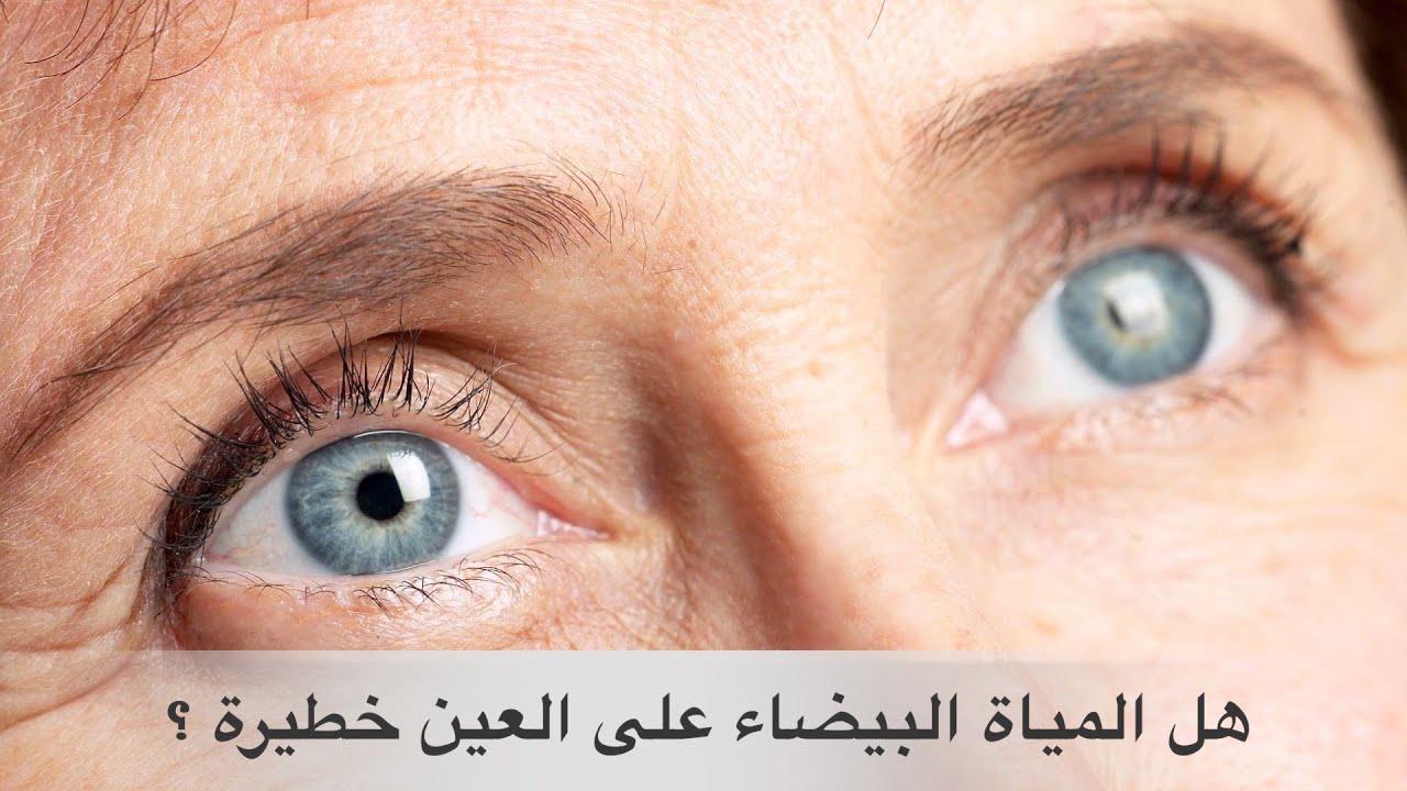 مخاطر المياه البيضاء على العين وعلاجها