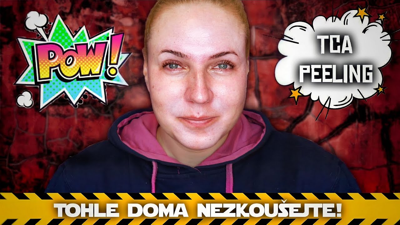 🥵 Tak tohle bolelo 🥵 | TCA peeling 25% 🧪 |🔎 Teorie, aplikace a i denní update 🔍