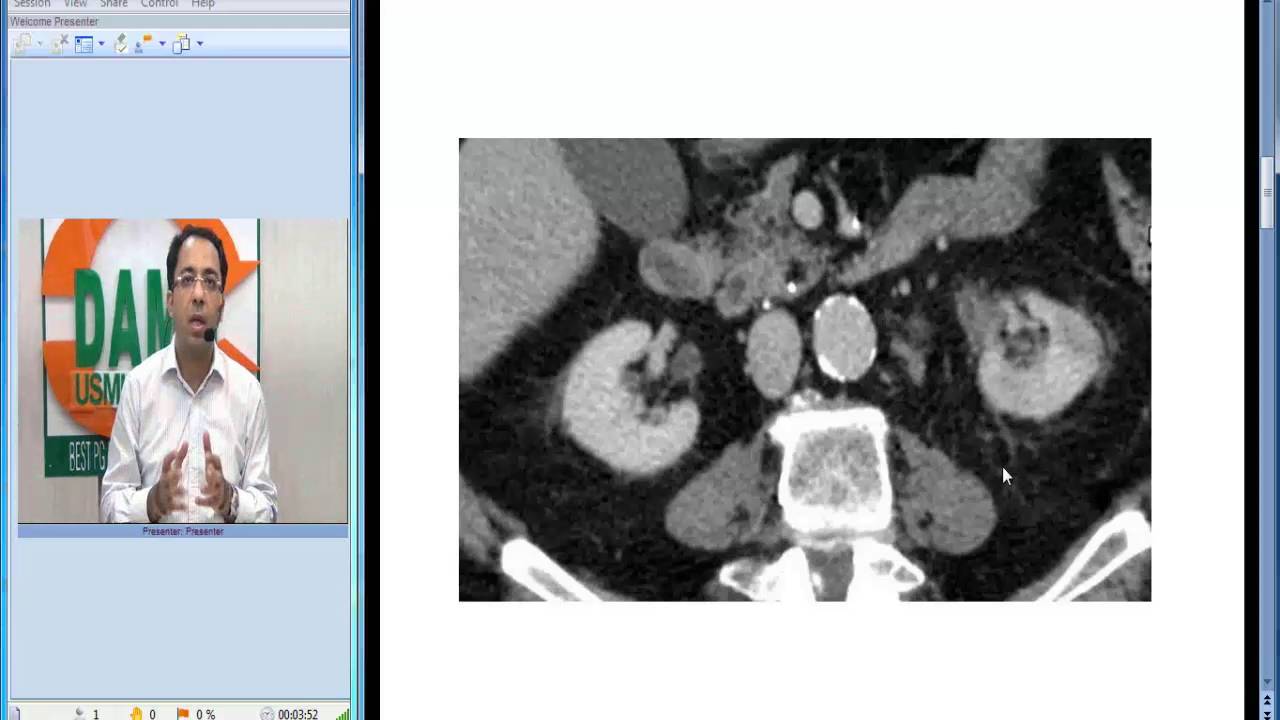 Radiology Spotters 27 - NCCT For Ureteric Stone by Dr Sumer Sethi