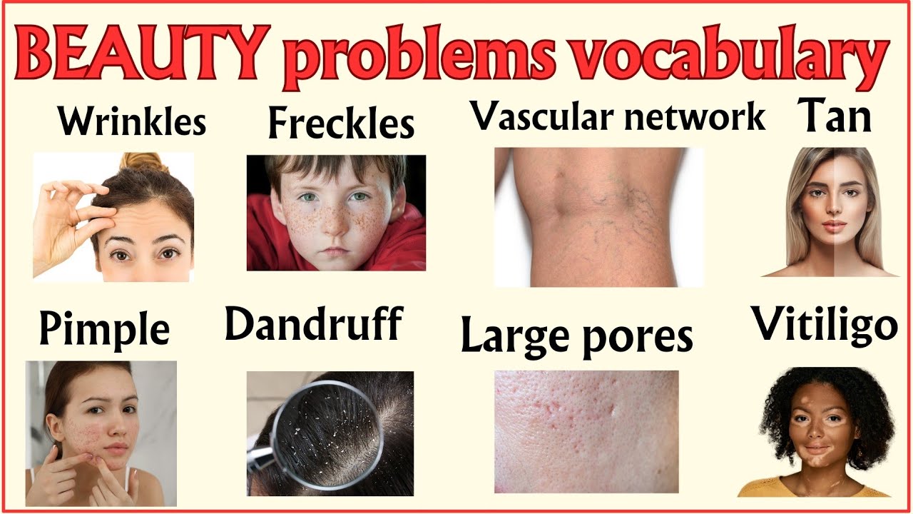 Lesson 22: Beauty & Face Problems Vocabulary #englishvocabulary #learnenglishwithpictures