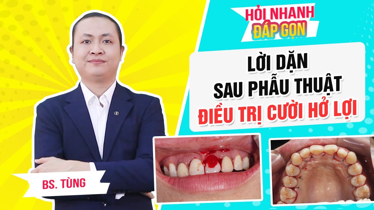 Lời dặn sau phẫu thuật Cười hở lợi