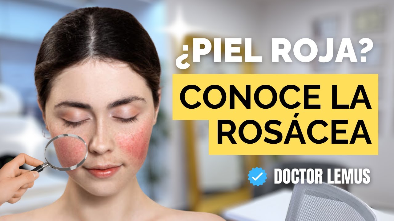 Acné vs Rosácea Tratamiento con Láser Fotona #rosacea #skincare