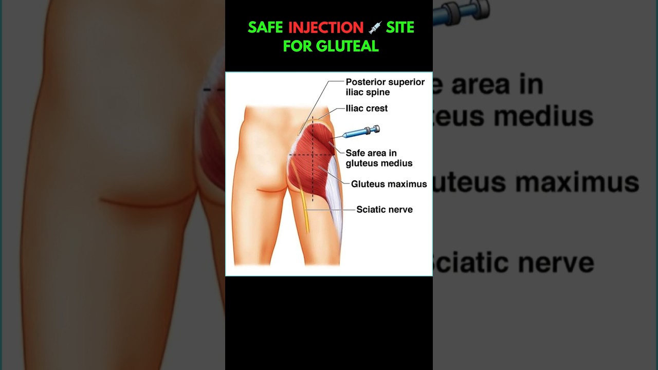 SAFE Injection 💉 Site For GLUTEAL MUSCLE #injection #site #shorts #muscle