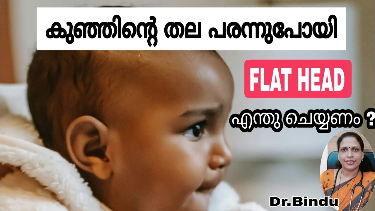 #99 കുഞ്ഞിന്റെ തല പരന്നു പോയാൽ എന്തു ചെയ്യും/Flat head in babies Prevention and treatment
