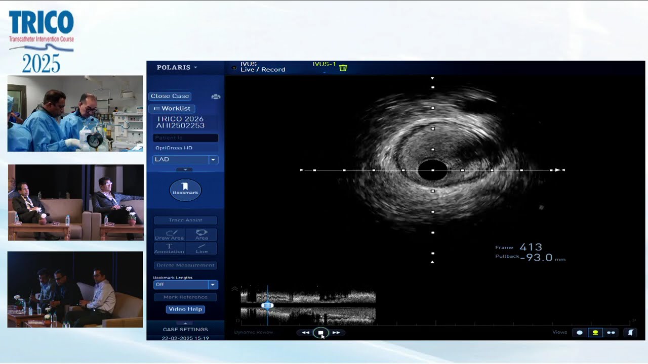 Precision in Bifurcation PCI | Dr. Tak Kwan’s Masterclass on OCT & IVUS | TRICO 2025