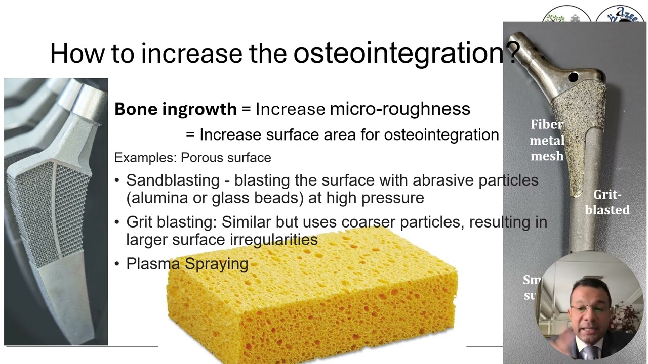 Cementless  stems - Designs and Surface finish - AAAzeem 2025