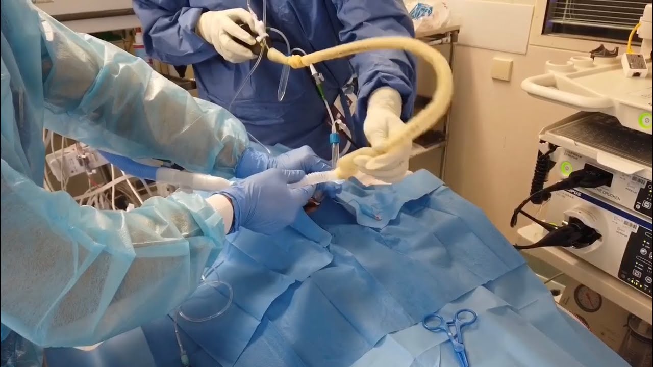 aersolreduzierte Bronchoskopie bei SARS CoV-2 (Covid19)