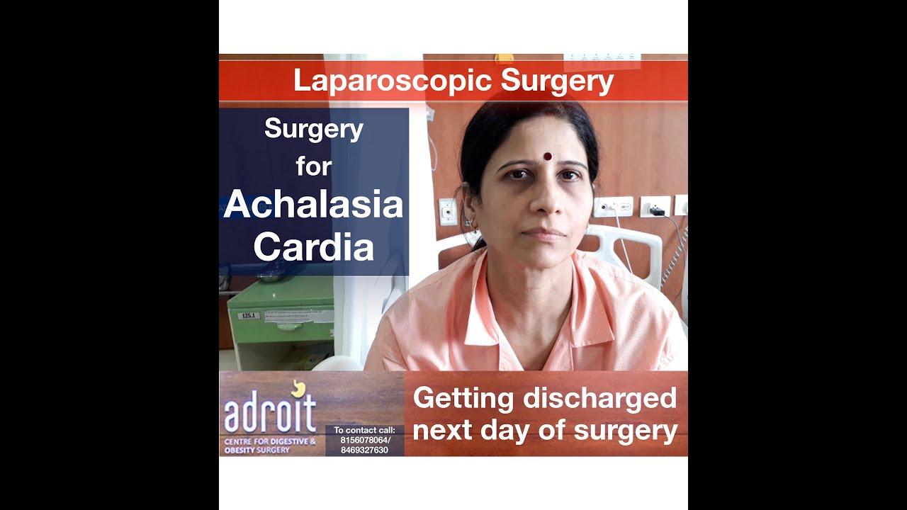 एकेलेसिआ कार्डिआ लैप्रोस्कोपिक ऑपरेशन Laparoscopic surgery for Achalasia Cardia: Patient review