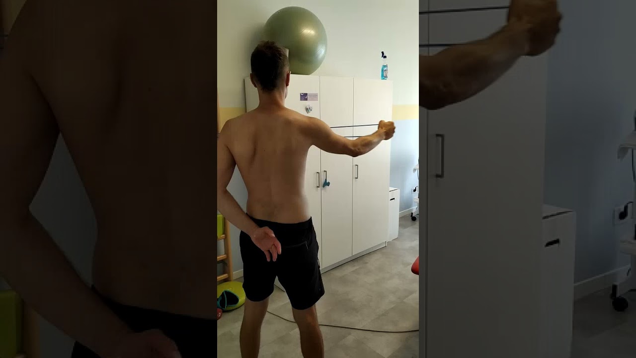 DISCINESIA SCAPOLARE