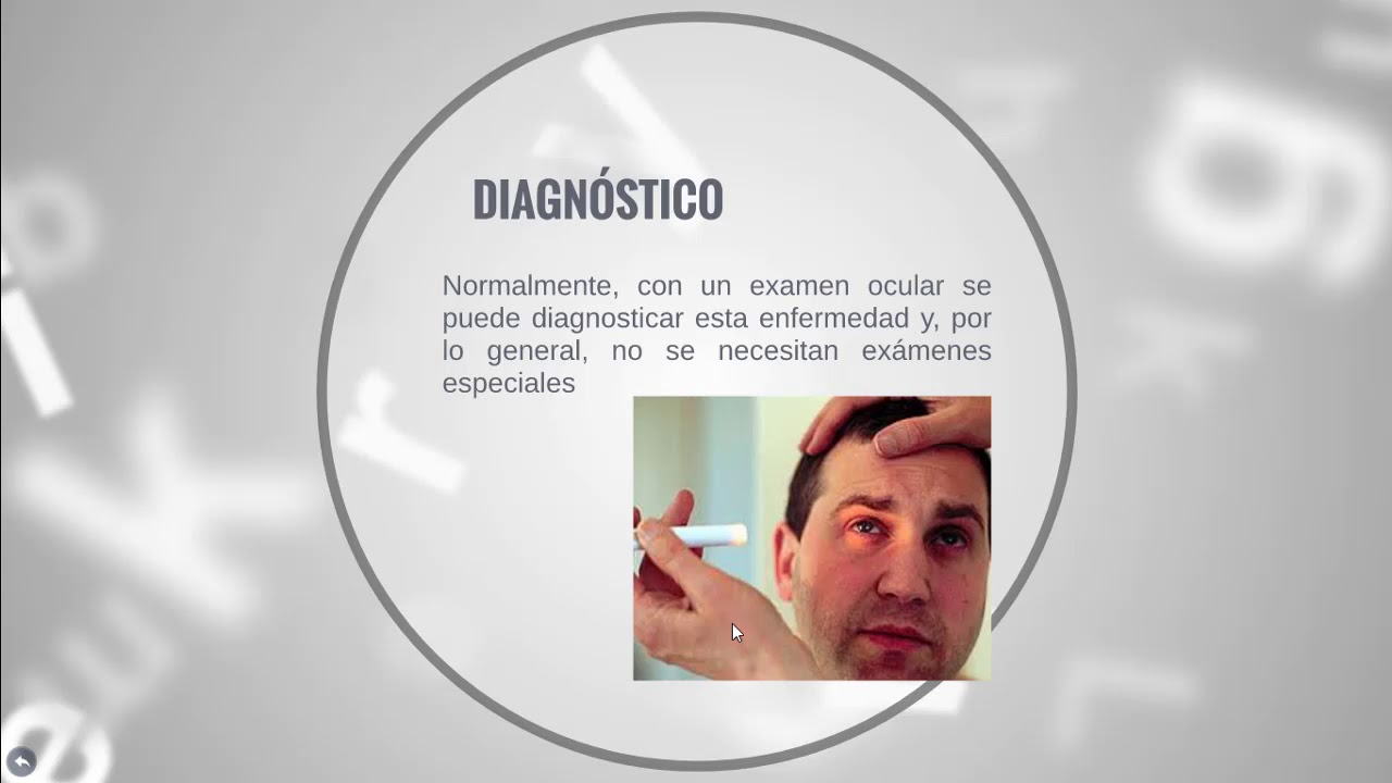 Epiescleritis por Raquel V&aacute;zquez