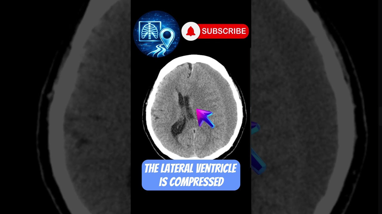 Not Bright. Not Fresh. Still Life-Threatening.