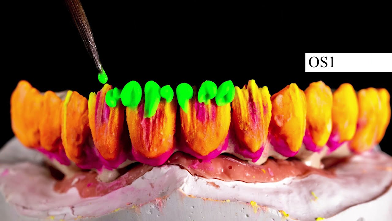 Heraceram saphir Metal- ceramic build-up