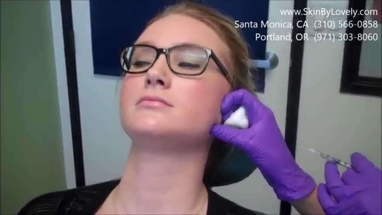 Treating Teeth Grinding and Masseter muscle with Botox   Holly Gruwell Buchko FNP   Skin by Lovely