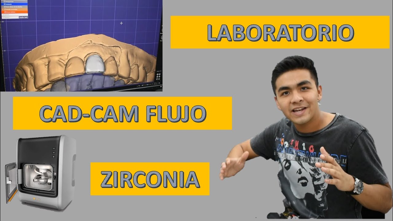 FABRICANDO CORONAS DE ZIRCONIA!!! (CAD-CAM DENTAL) Flujo de trabajo en laboratorio I OdontoDummies