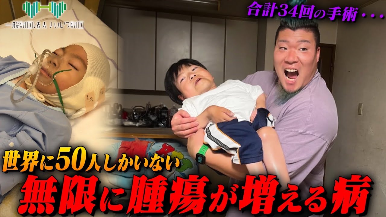 【14歳で手術34回】腫瘍が無限に増え続ける病と戦う少年
